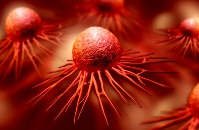 Compugen doses first patient in phase 1 trial of cancer immunotherapy COM701